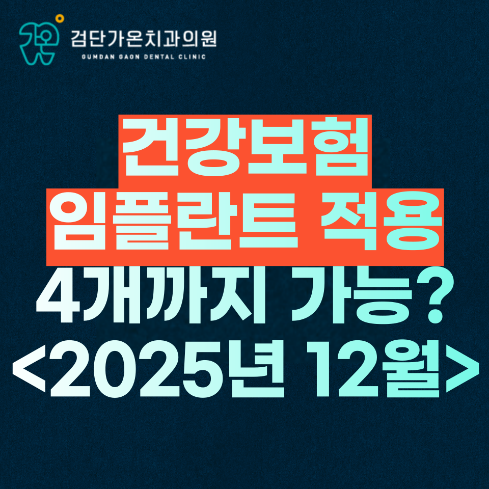 건강보험 임플란트 적용 4개까지 가능? <2025년 12월>