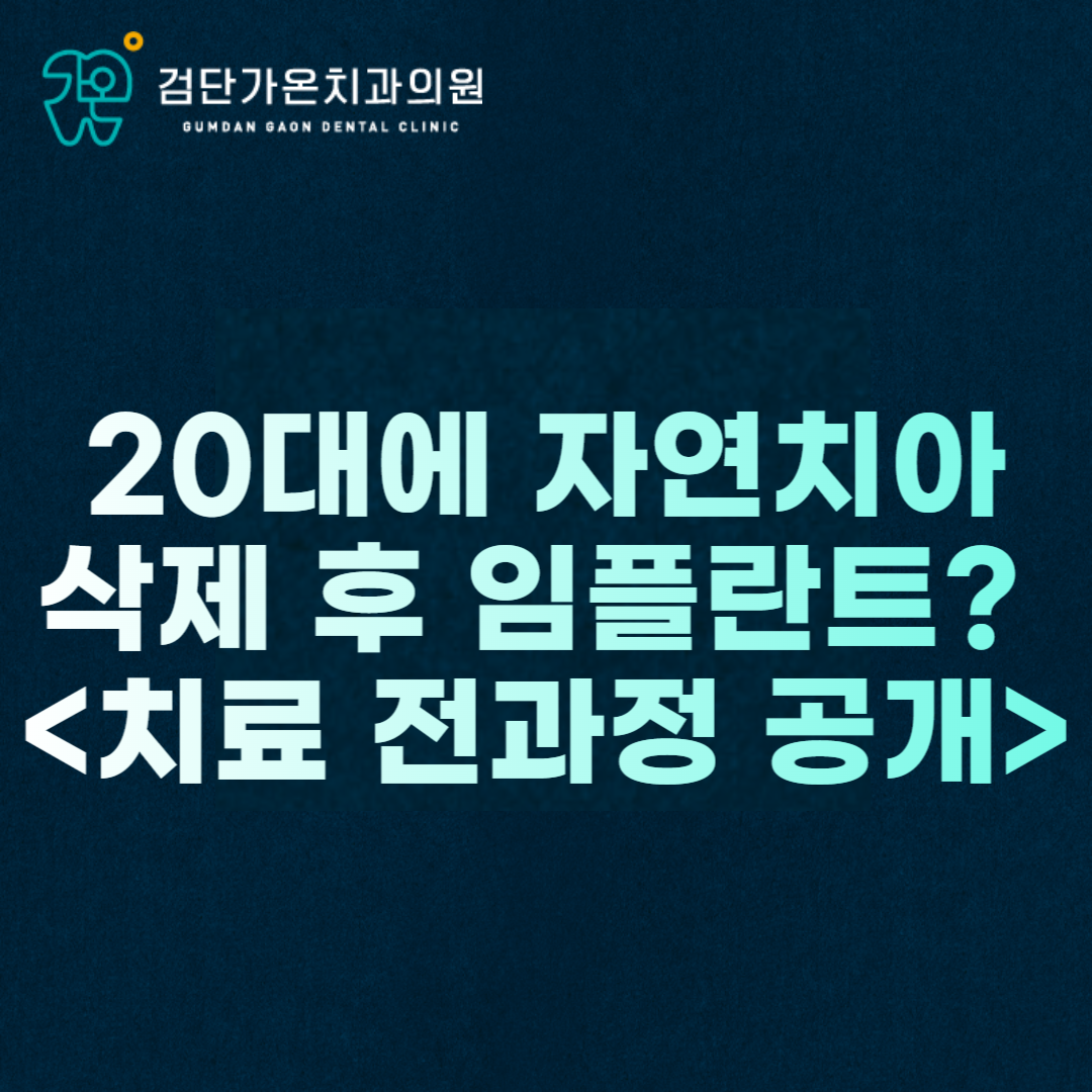 인천 검단 임플란트 치과, 20대에 자연치아 삭제 후 임플란트? <치료 전과정 공개>