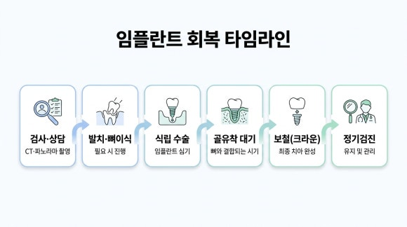 임플란트 회복 타임라인
