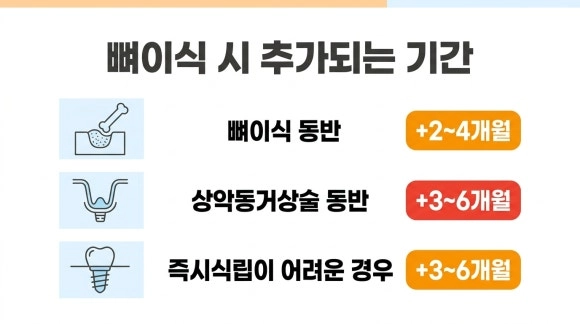 뼈이식 시 추가되는 기간 도식 - AI 도식은 이해를 돕기 위한 개략도이며, 실제 치아 상태·치료 과정과 차이가 있을 수 있습니다.