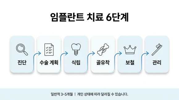 임플란트 6단계 흐름 (AI 도식)
