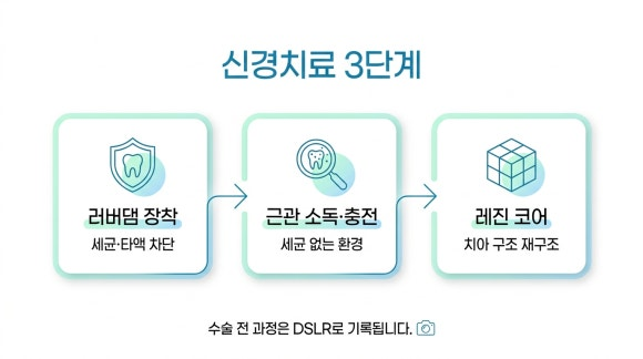 신경치료 3단계