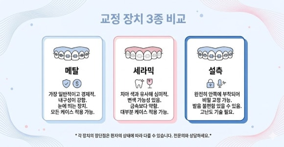 교정 장치 3종 비교