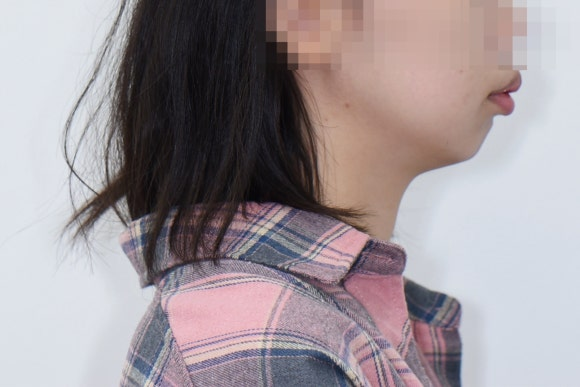 구외 사진 — 측면