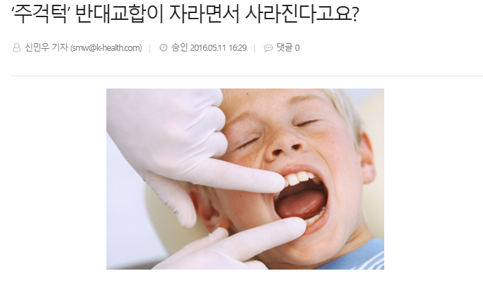 출처 : 헬스경향 - ‘주걱턱’ 반대교합이 자라면서 사라진다고요?