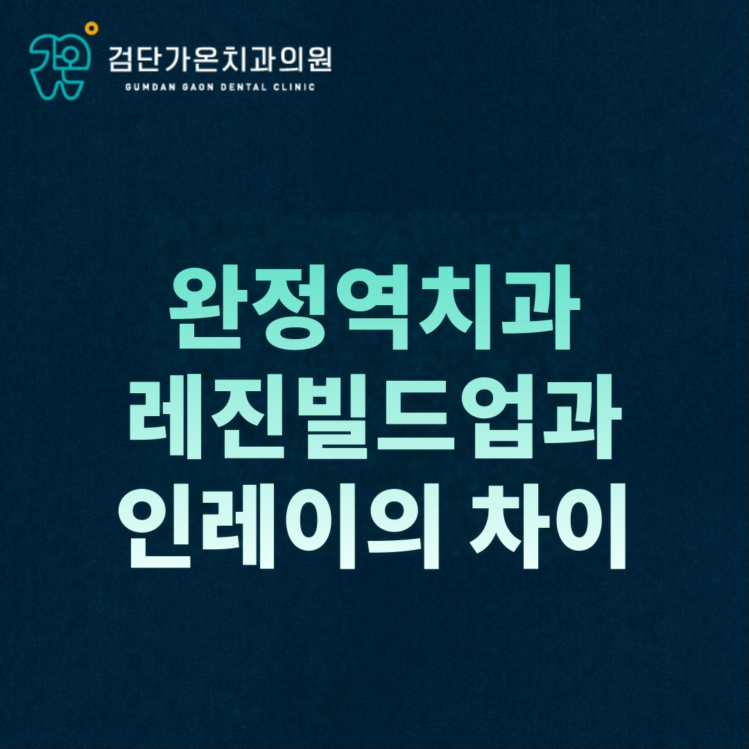 완정역치과가 설명하는 레진빌드업과 인레이의 차이